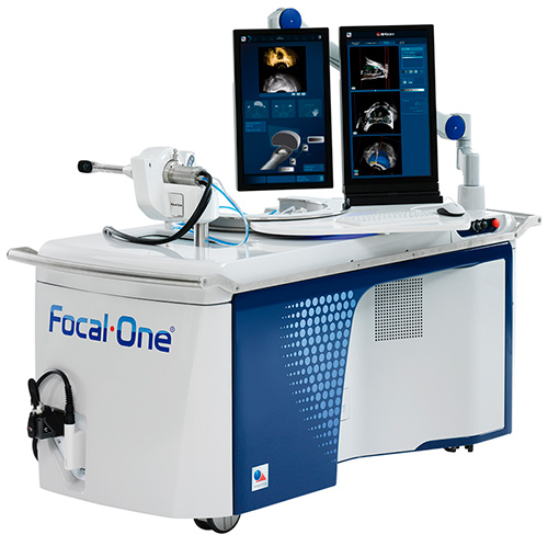 Focal One® HIFU – лікування пухлин передміхурової залози ультразвуком.